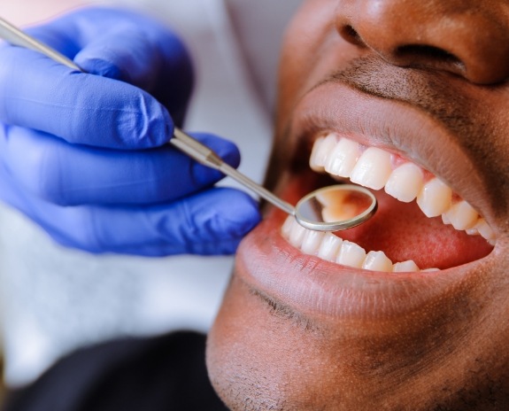 Dentist examining smile after tooth colored filling treatment