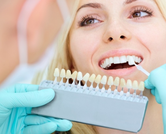 Woman's smile compared with porcelain veneers shade chart