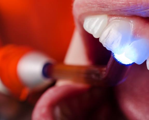 Closeup of patient receiving cosmetic dental bonding