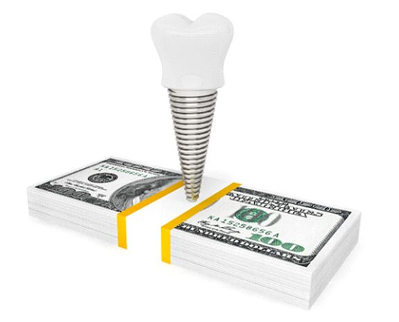 Dental implant in Florence on top of dollar bills
