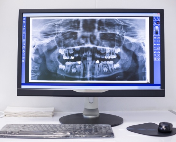 Digital dental x-rays on tablet computer