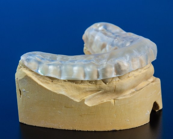 Model smile with occlusal splint in place